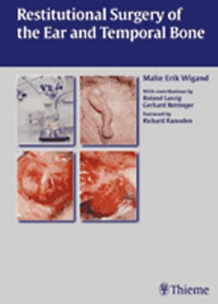 Produktbild: Restitutional Surgery of the Ear and Temporal Bone