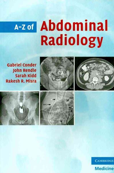 Produktbild: Conder, G: A-Z of Abdominal Radiology