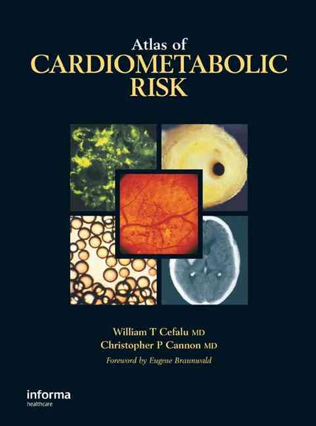 Produktbild: Atlas of Cardiometabolic Risk