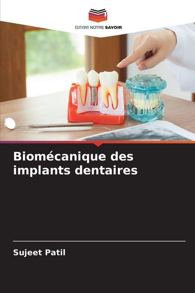 Produktbild: Biom&eacute;canique des implants dentaires