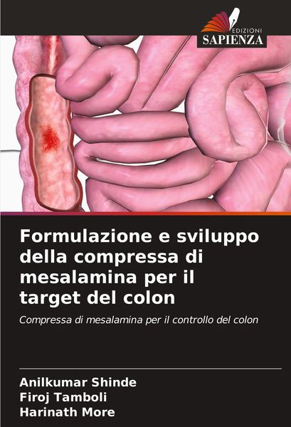Produktbild: Formulazione e sviluppo della compressa di mesalamina per il target del colon