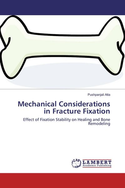 Produktbild: Mechanical Considerations in Fracture Fixation