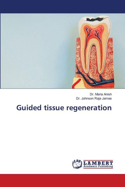 Produktbild: Guided tissue regeneration