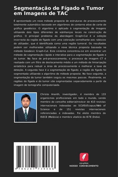 Produktbild: Segmenta&ccedil;&atilde;o de F&iacute;gado e Tumor em Imagens de TAC