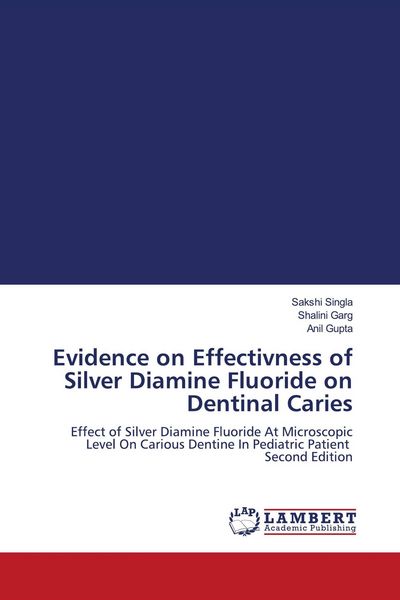 Produktbild: Evidence on Effectivness of Silver Diamine Fluoride on Dentinal Caries