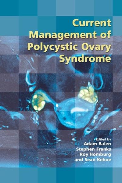 Produktbild: Current Management of Polycystic Ovary Syndrome