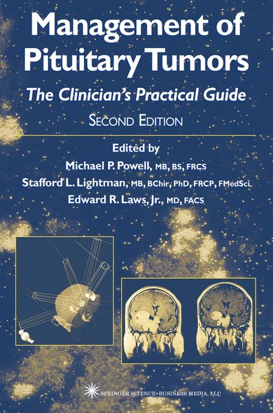 Produktbild: Management of Pituitary Tumors