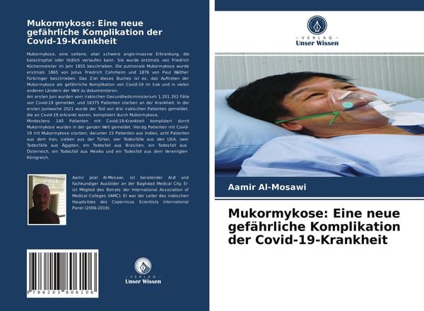 Produktbild: Mukormykose: Eine neue gef&auml;hrliche Komplikation der Covid-19-Krankheit