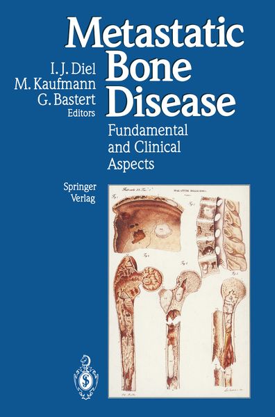 Produktbild: Metastatic Bone Disease