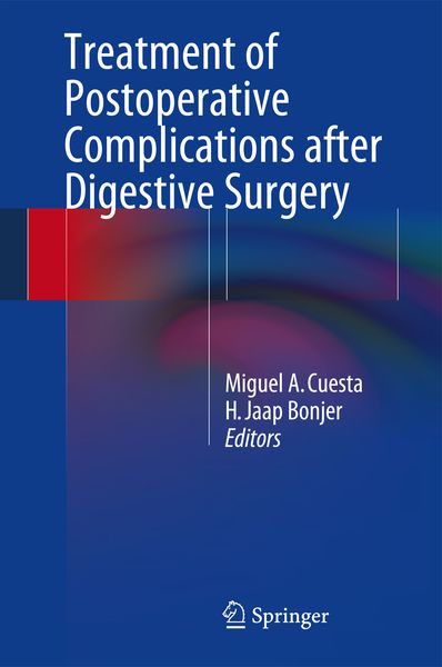 Produktbild: Treatment of Postoperative Complications After Digestive Surgery