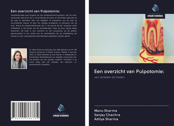 Produktbild: Een overzicht van Pulpotomie: