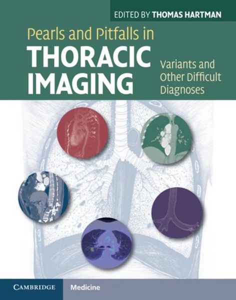 Produktbild: Pearls and Pitfalls in Thoracic Imaging