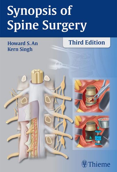 Produktbild: Synopsis of Spine Surgery