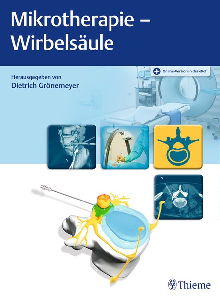 Produktbild: Mikrotherapie - Wirbels&auml;ule