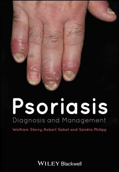Produktbild: Psoriasis