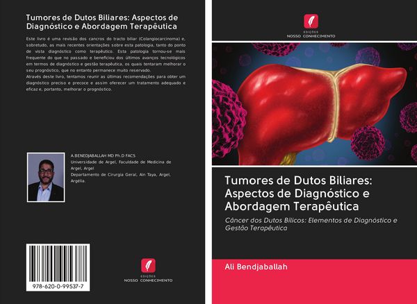 Produktbild: Tumores de Dutos Biliares: Aspectos de Diagn&oacute;stico e Abordagem Terap&ecirc;utica