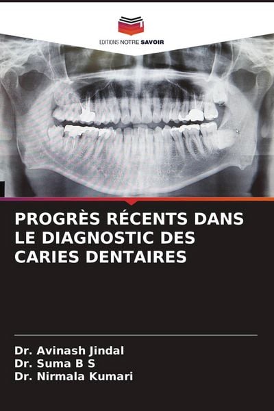 Produktbild: Progr&egrave;s R&eacute;cents Dans Le Diagnostic des Caries Dentaires