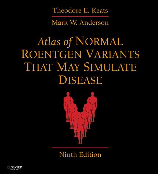 Produktbild: Atlas of Normal Roentgen Variants That May Simulate Disease E-Book