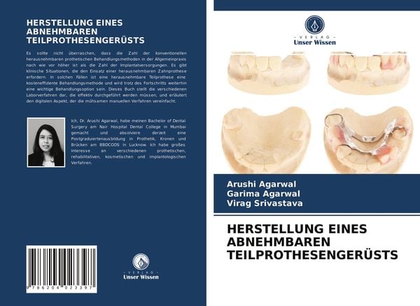 Herstellung Eines Abnehmbaren Teilprothesengerüsts, Taschenbuch von Arushi Agarwal , Garima Agarwal , Virag Srivastava, Verlag Unser Wissen,