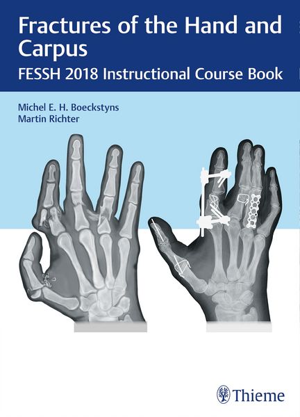 Produktbild: Fractures of the Hand and Carpus