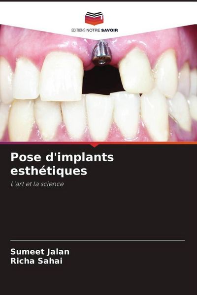 Produktbild: Pose d'implants esth&eacute;tiques