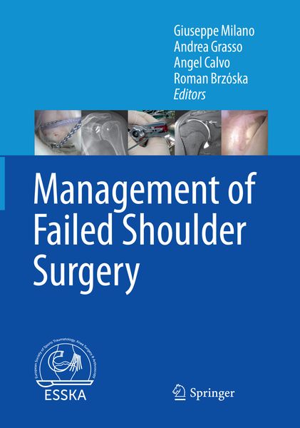 Produktbild: Management of Failed Shoulder Surgery
