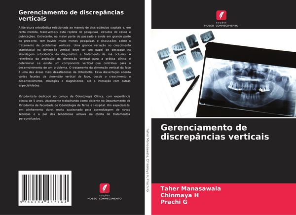 Produktbild: Gerenciamento de discrep&acirc;ncias verticais