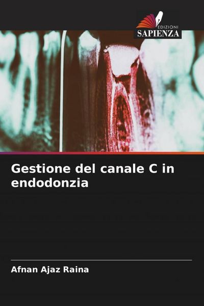 Produktbild: Gestione del canale C in endodonzia