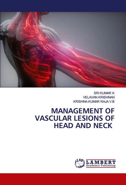 Produktbild: Management Of Vascular Lesions Of Head and Neck