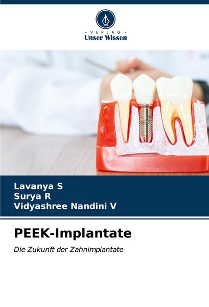 Produktbild: PEEK-Implantate