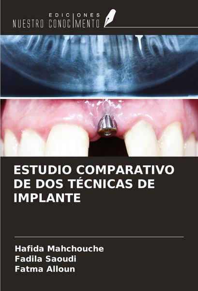 Produktbild: Estudio Comparativo De Dos T&eacute;cnicas De Implante