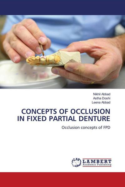 Produktbild: Concepts Of Occlusion in Fixed Partial Denture