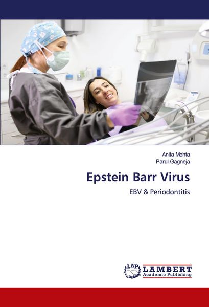 Produktbild: Epstein Barr Virus