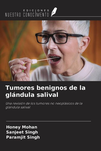 Produktbild: Tumores benignos de la gl&aacute;ndula salival