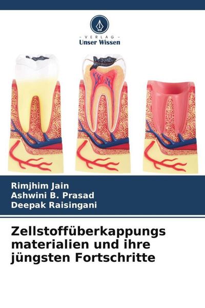Zellstoffüberkappungs materialien und ihre jüngsten Fortschritte, Taschenbuch von Rimjhim Jain , Ashwini B. Prasad , Deepak Raisingani, Verlag Unser