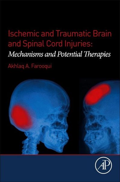 Produktbild: Ischemic and Traumatic Brain and Spinal Cord Injuries