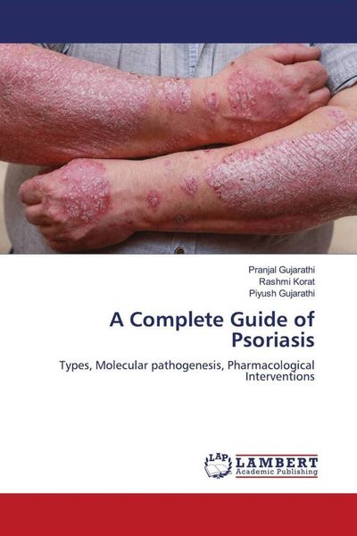 Produktbild: A Complete Guide of Psoriasis