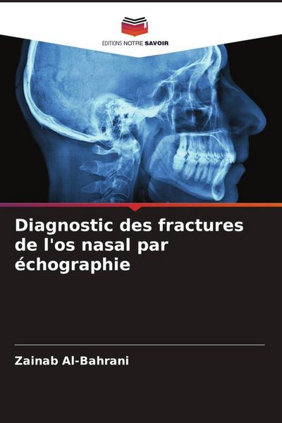 Produktbild: Diagnostic des fractures de l'os nasal par &eacute;chographie