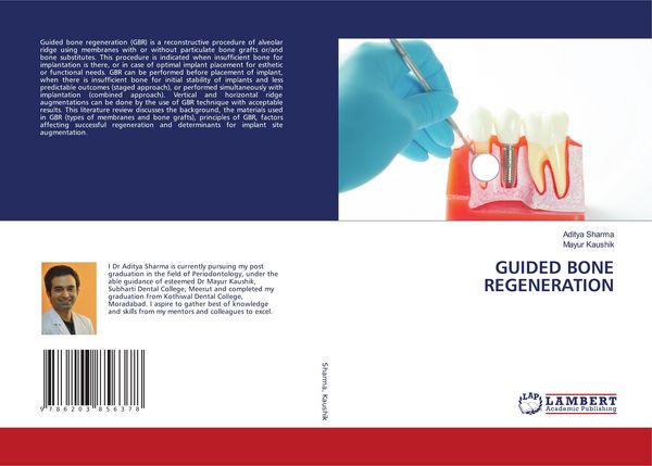 Produktbild: Guided Bone Regeneration