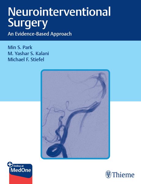 Produktbild: Neurointerventional Surgery