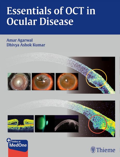 Produktbild: Essentials of OCT in Ocular Disease