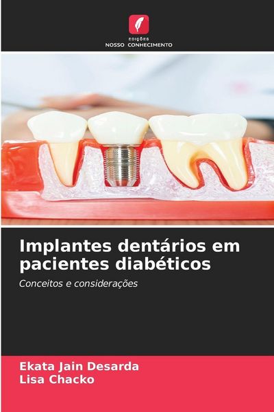 Produktbild: Implantes dent&aacute;rios em pacientes diab&eacute;ticos