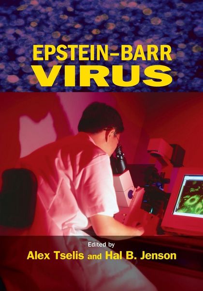 Produktbild: Epstein-Barr Virus
