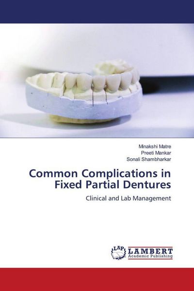 Produktbild: Common Complications in Fixed Partial Dentures