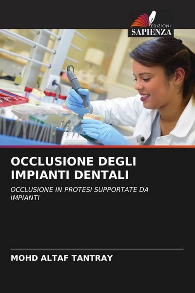 Produktbild: Occlusione Degli Impianti Dentali
