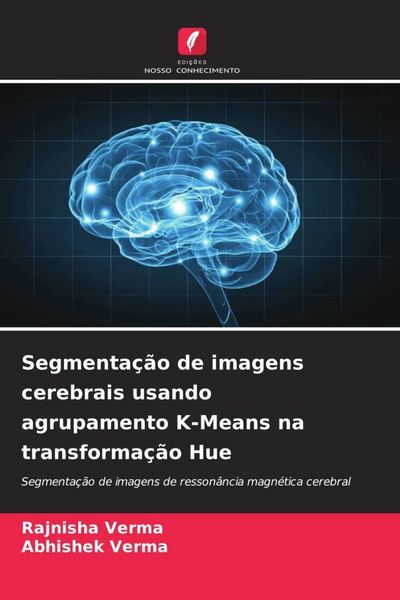 Produktbild: Segmenta&ccedil;&atilde;o de imagens cerebrais usando agrupamento K-Means na transforma&ccedil;&atilde;o Hue