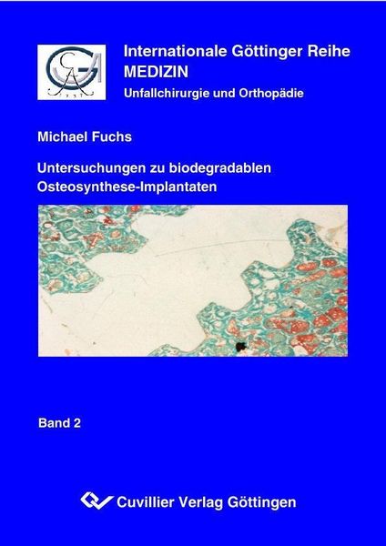 Produktbild: Untersuchungen zu biodegradablen Osteosynthese-Implantaten