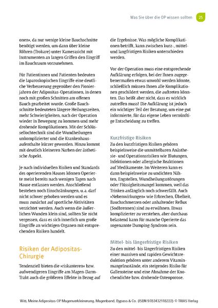 Produktbild: Meine Adipositas-OP. Magenverkleinerung, Magenband, Bypass & Co.