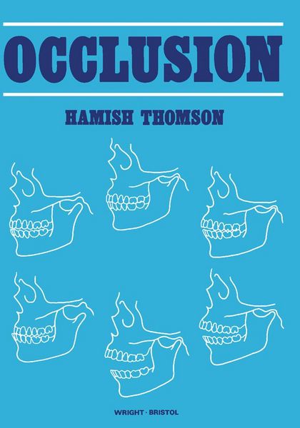 Produktbild: Occlusion