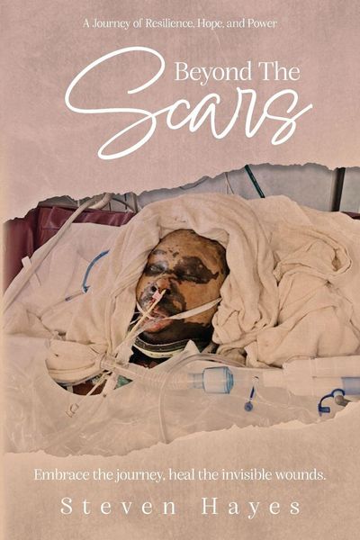 Produktbild: Beyond The Scars